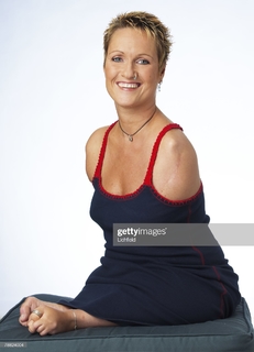Alison Lapper