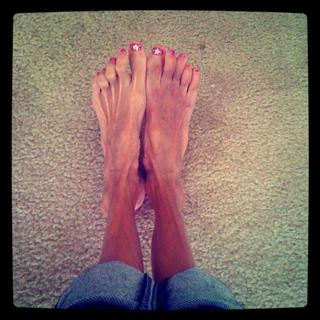 Lizzie Velasquez