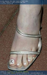 Alison Arngrim